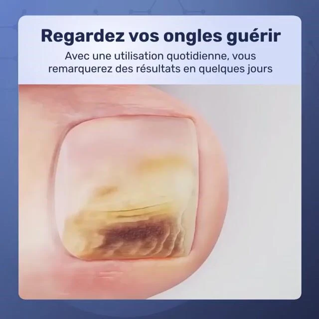 WellNail image